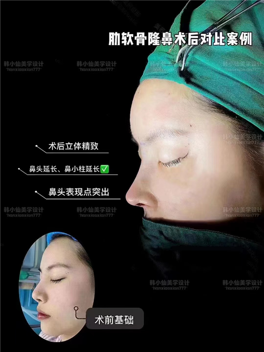 上海DRO整形