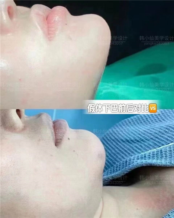 上海中韩国际整形医院