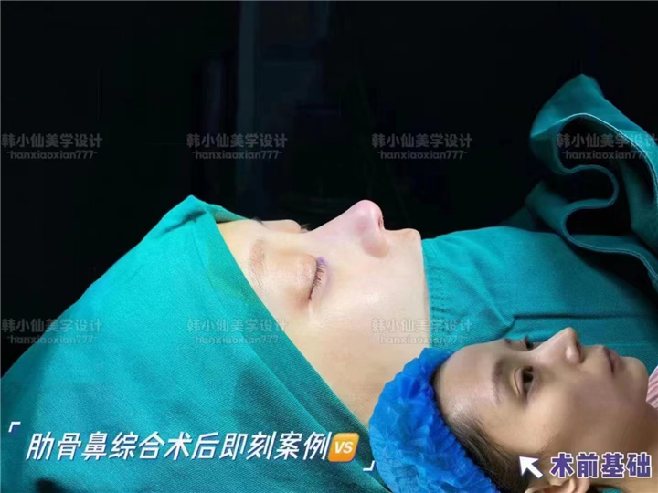 上海DRO整形