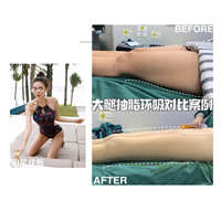 七星国际艺容术整形怎么样