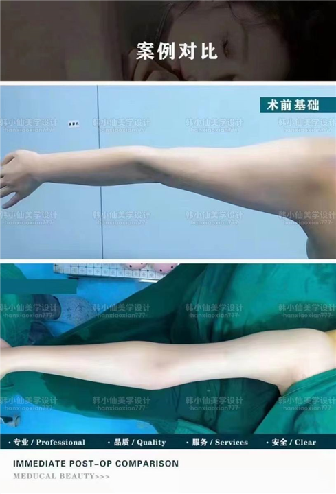 上海HZ整形