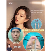 上海DRO整形