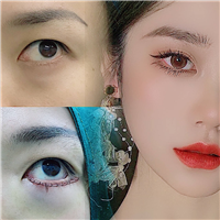 上海芭比眼整形 