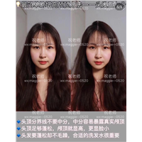 头皮筋膜饱满激活术