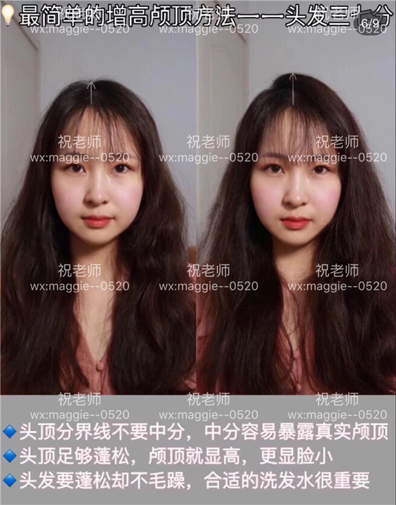 头皮筋膜饱满激活术