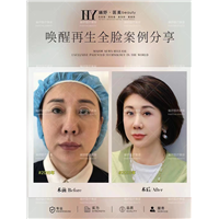 唤醒再生术全脸案例
