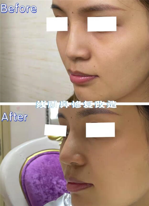 唤醒再生美学
