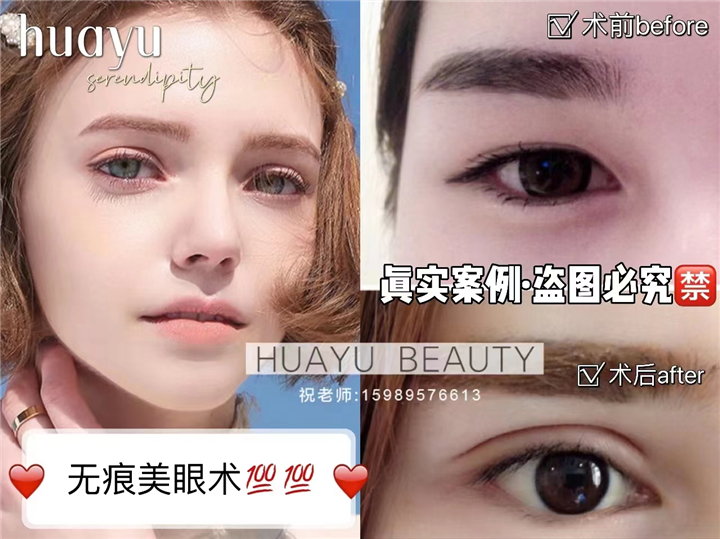 pc美眼案例