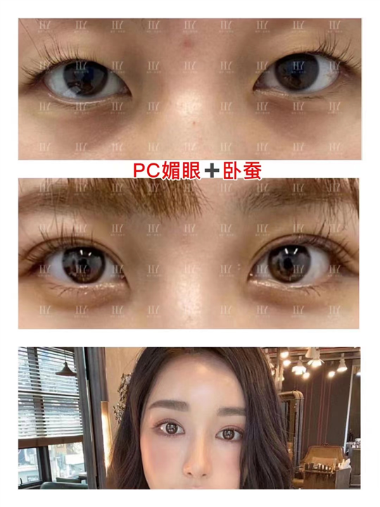 pc美眼案例