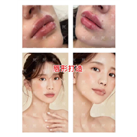 唇部再生激活案例