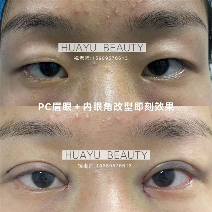 pc美眼案例