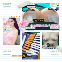 自体脂肪填充 
