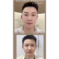 逆龄抗衰黑科技，双面网兜提升