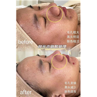 艾沫尔