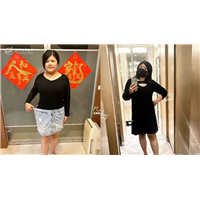 台湾Mini胃减重