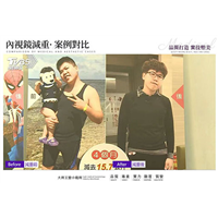 台湾mini胃内视镜减重案例