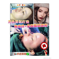 北京**网红整形医院