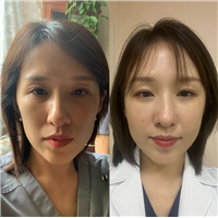 北京面部综合抗衰老专家