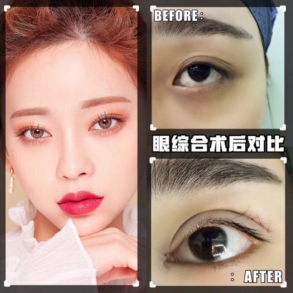 玲珑梵宫整形医院|北京网红整形