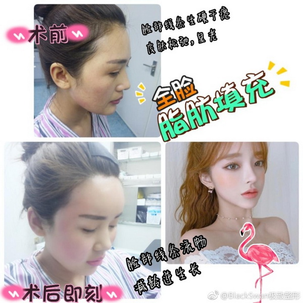北京玲珑梵宫