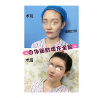 北京**网红整形医院
