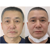 北京面部年轻化专家