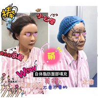 北京**网红整形医院