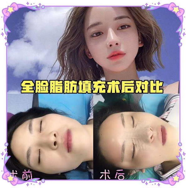 北京玲珑梵宫
