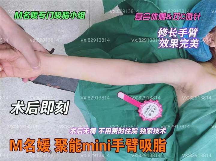郑州吸脂哪家好