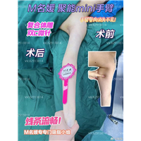 郑州无痛吸脂