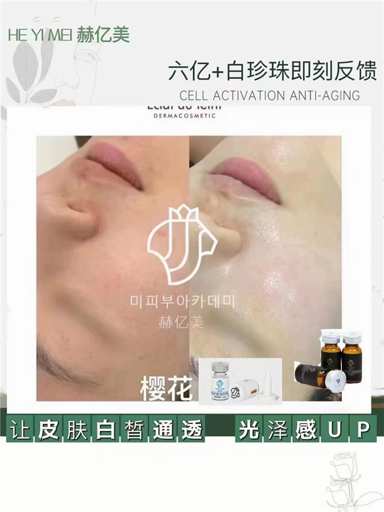 樱花瓷肌培植代理