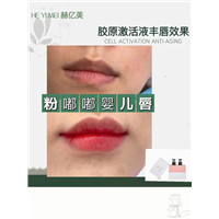 樱花瓷肌培植术怎么加盟