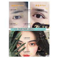 七星整形眼综合价格 