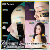 鼻综合整形价格