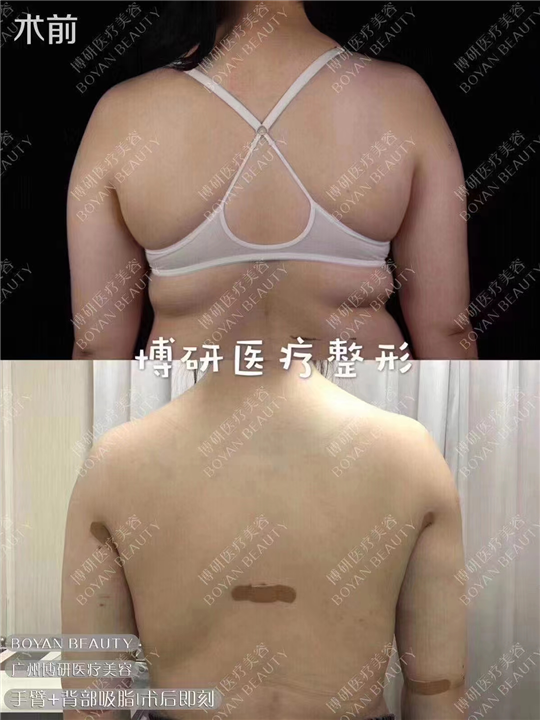 广州博研医疗美容