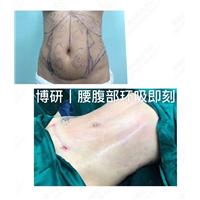 广州博研医学美容