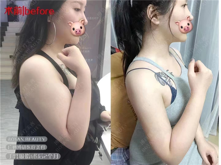 广州博研医疗美容