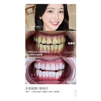 牙齿矫正，是不是超级疼疼疼？