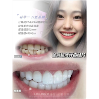 什么是瓷贴面？
