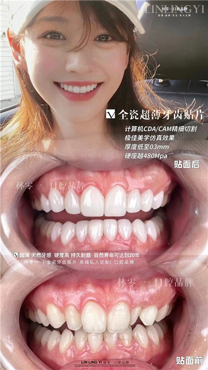 洗牙有什么好处？