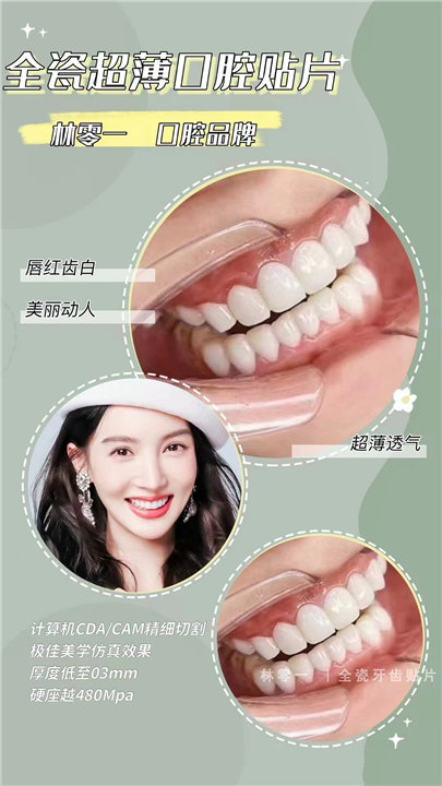 关于种植牙，你需要知道的不仅仅是听说过。