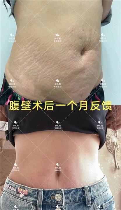 杭州徐礼亮医生