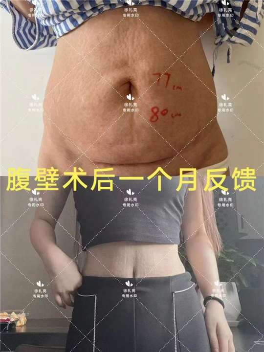 杭州徐礼亮医生