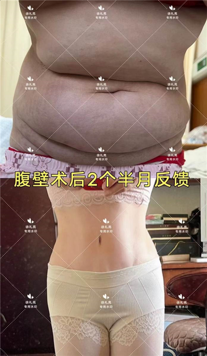 杭州徐礼亮医生
