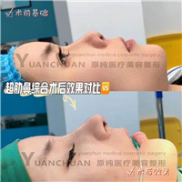 济南鼻综合整形