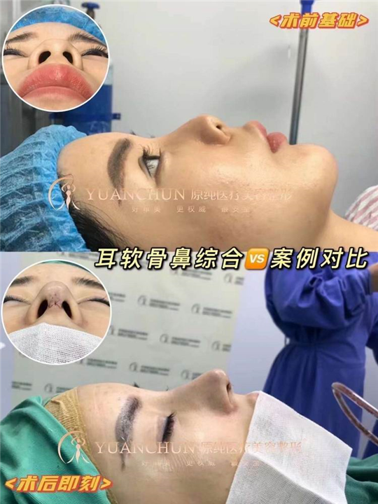 济南鼻综合整形