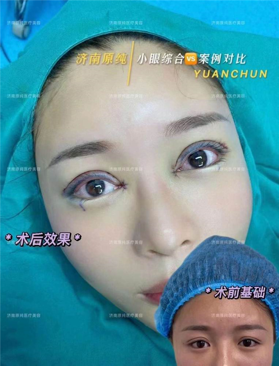 济南眼综合整形
