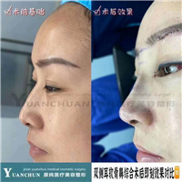 济南鼻综合整形