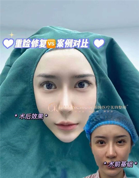 济南眼综合整形