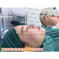 济南鼻综合整形